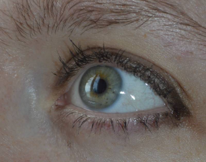 Плавающее пятно в глазу: причины и лечение - "здоровое око"