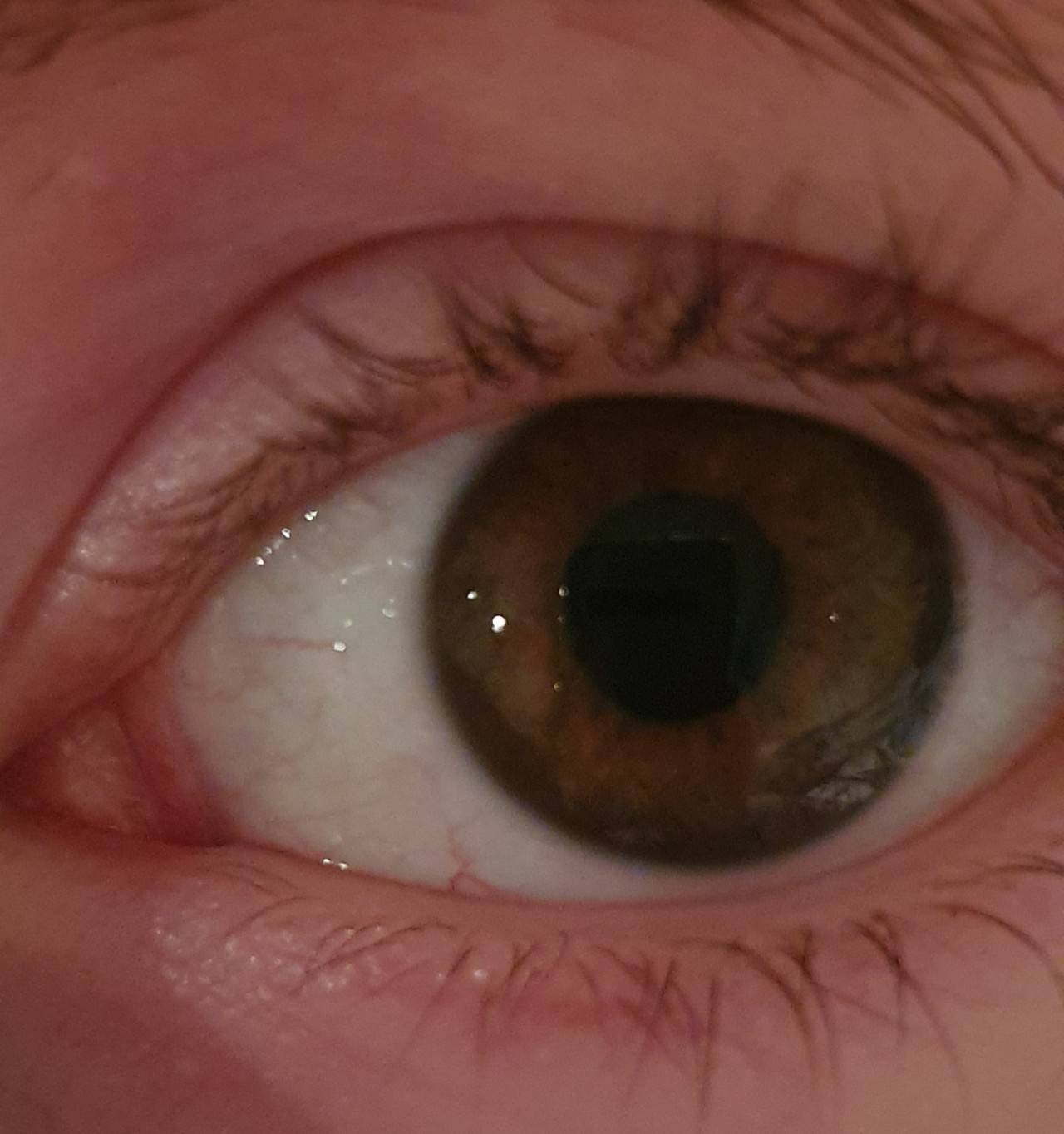 Почему же всегда появляются эти неприятные симптомы? причины постоянно красных глаз