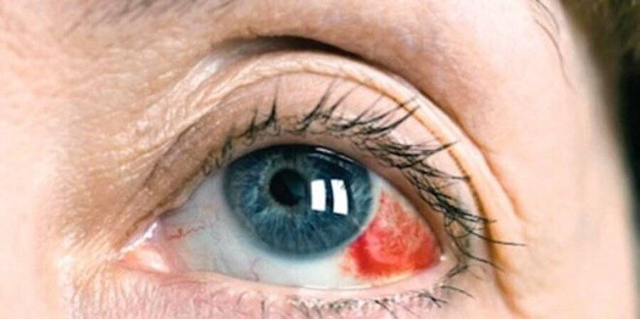 Болит глазное яблоко: причины, симптомы, лечение