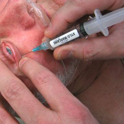 Лечение интравитреальными инъекциями: эффективные препараты для уколов в глаза для сетчатки