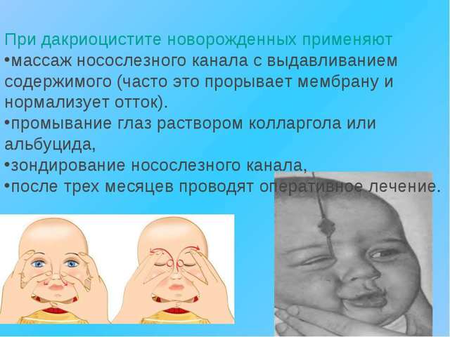 Дакриоцистит у новорожденных и детей: (38 фото): симптомы и лечение каплями, массаж при врожденной форме