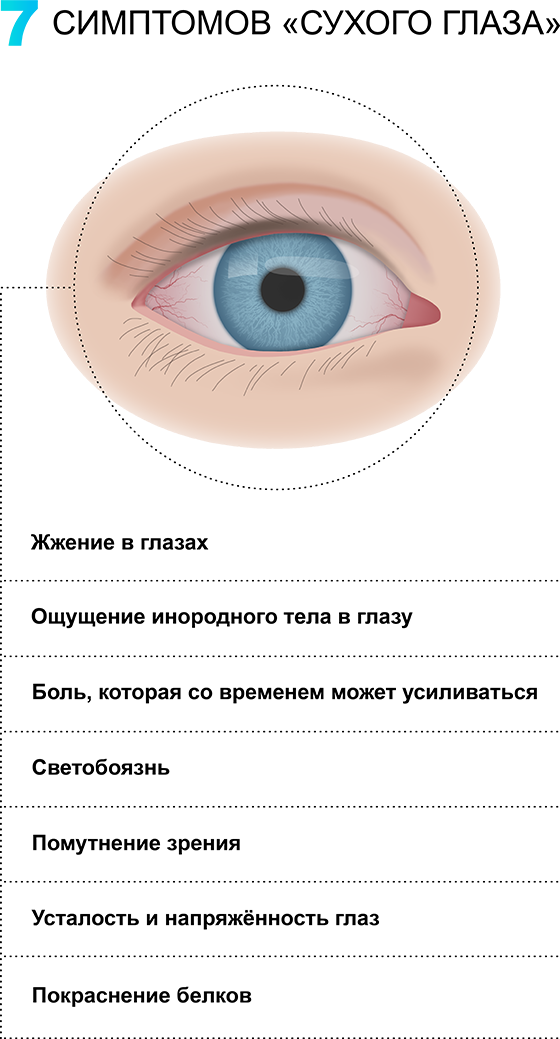 Синдром сухого глаза – симптомы и лечение