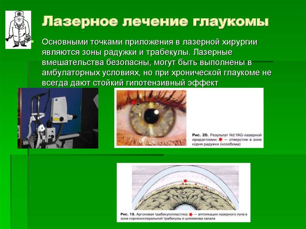 Операция при глаукоме на глаза: виды, стоимость,последствия
