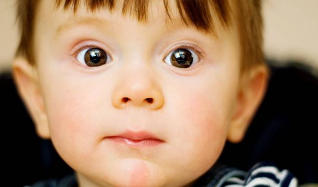 Почему у ребенка расширенные зрачки: ищем причину и способы терапии патологии
