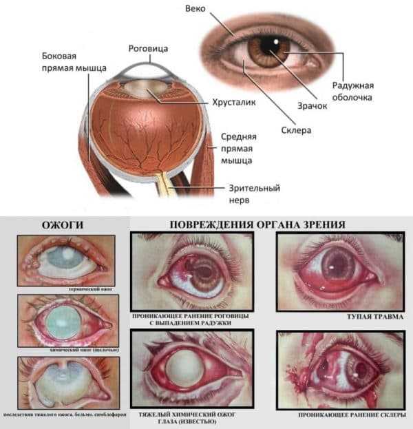 Ожог глаза сваркой: первая помощь, лечение, капли, народная медицина