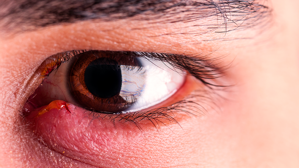 Болят глаза у ребенка при повышении температуры тела: основные причины