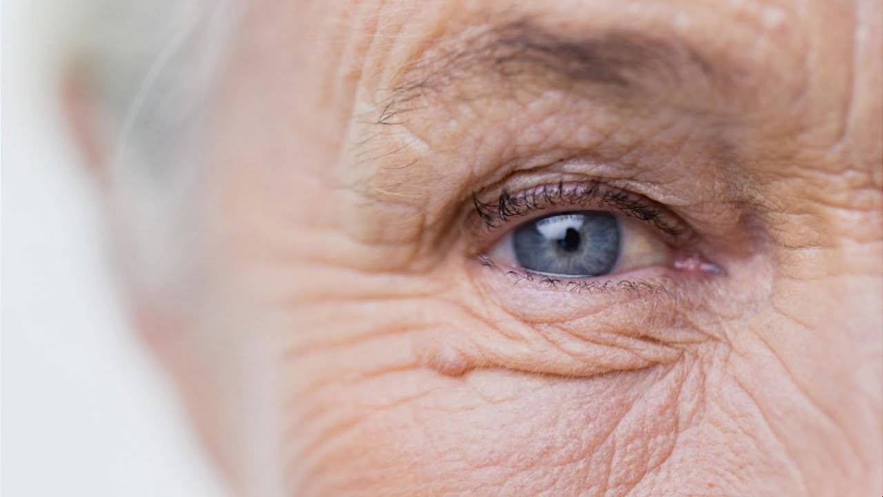 Незрелая катаракта: причины, симптомы, лечение, диагностика, виды (возрастная, сенильная, набухшая), профилактика, операция