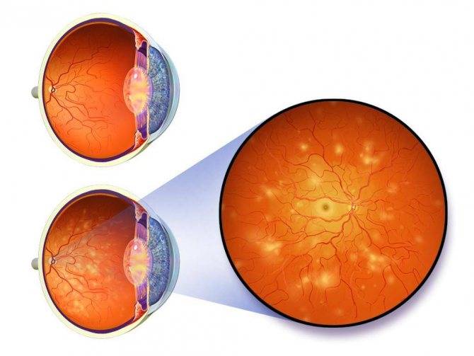 Препараты для укрепления сетчатки глаз