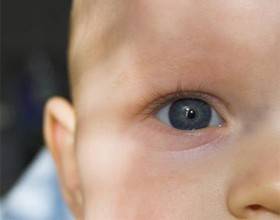 Мкб 10 - врожденная катаракта глаз у новорожденных детей: причины и лечение