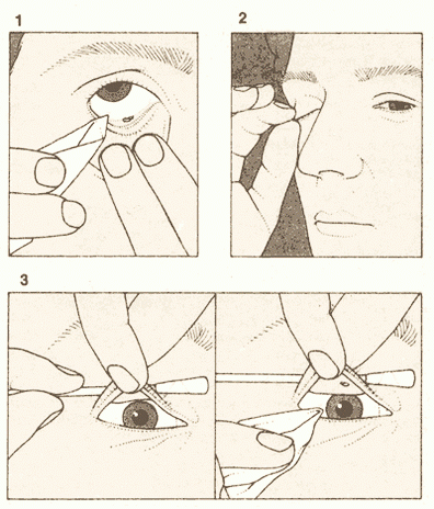 Промывание глаз: техника и правила проведения | компетентно о здоровье на ilive