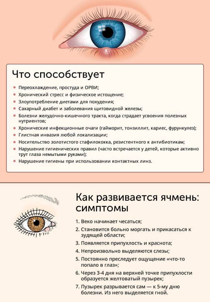 Внутренний ячмень на глазу: причины появления, особенности лечения oculistic.ru
внутренний ячмень на глазу: причины появления, особенности лечения