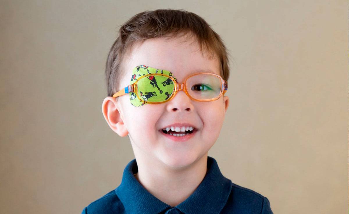 Окклюдер для глаз - что это, как носить для детей и взрослых