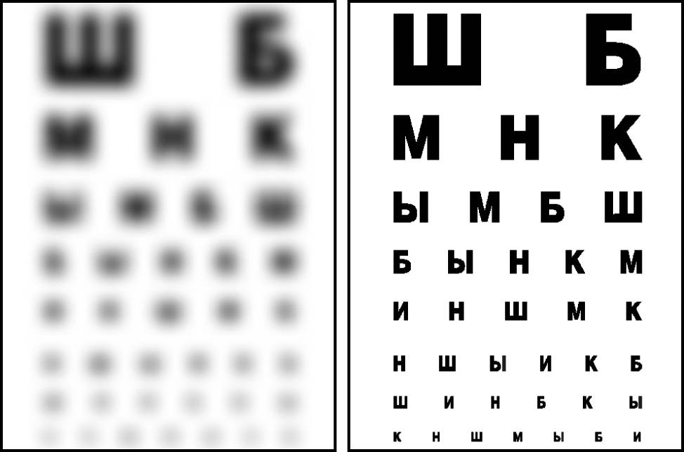 Зрение плюс 0,5 минус 0,5, что это значит? нужно носить очки?