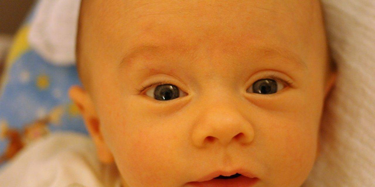 Желтые белки глаз у новорожденных: лечение (фото)