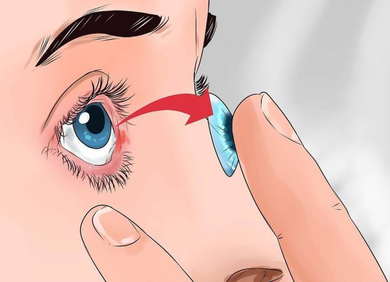 Топ-10 лучших глазных капель от слезоточивости глаз: описание и стоимость