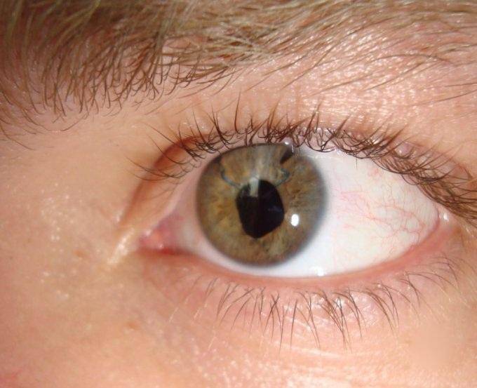 Разрыв сетчатки глаза: причины, симптомы, последствия и лечение - sammedic.ru