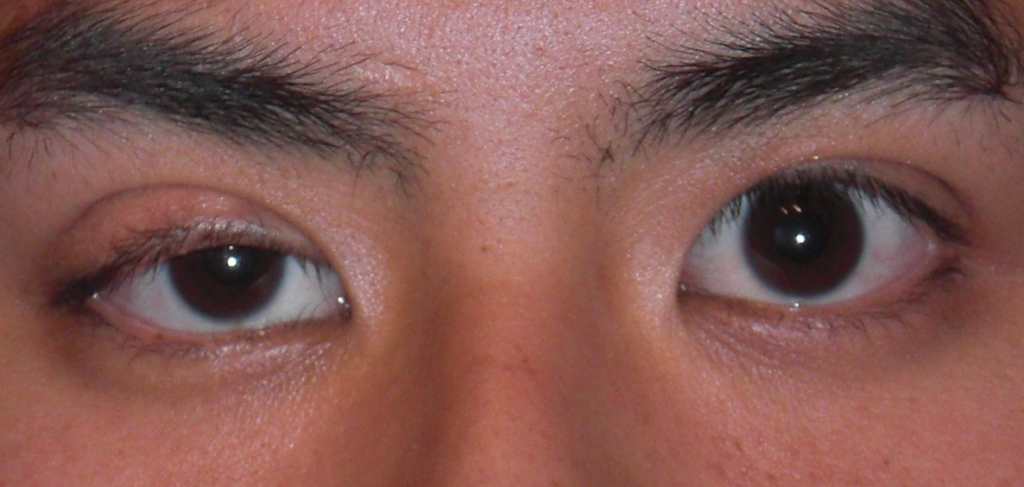 Один глаз выше другого макияж ркомендации косметолога восстановление зрения