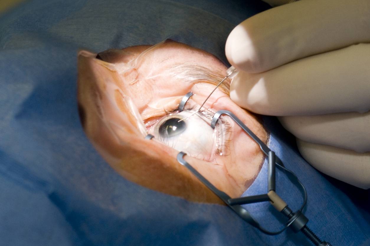 Операция по удалению глаза: как проходит - "здоровое око"