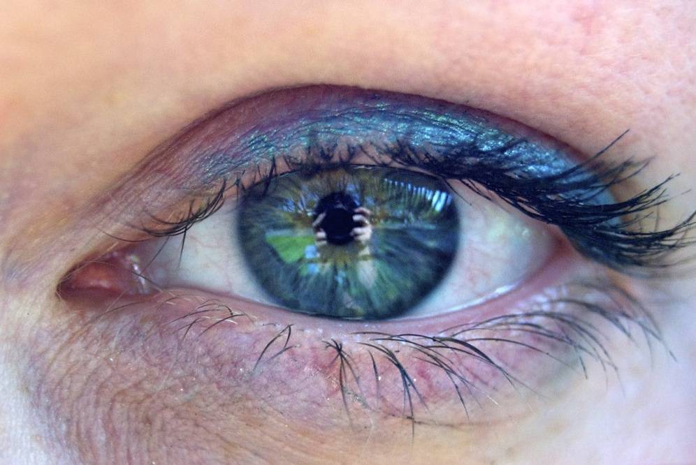 Эндотелиальная дистрофия роговицы глаза (синдром фукса)