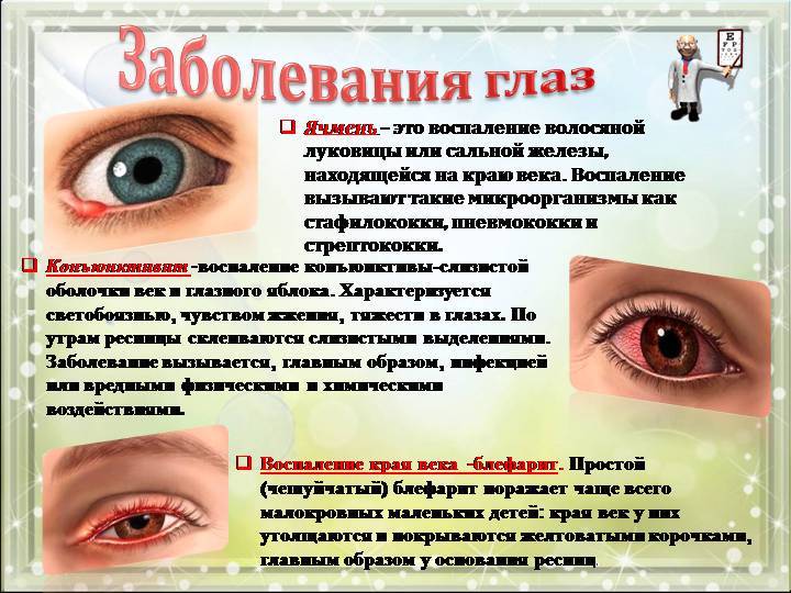 Болезни глаз у человека - названия, полный список
