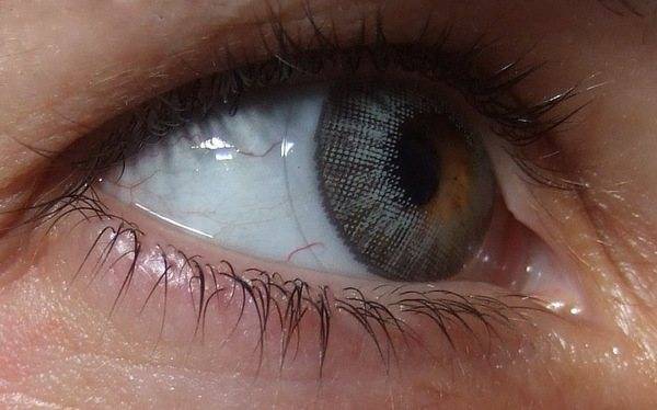 Вредны ли линзы для глаз