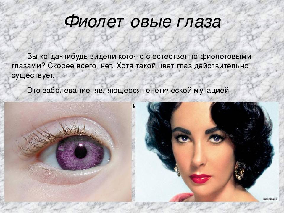 Фиолетовый цвет глаз: мифы и правда - "здоровое око"