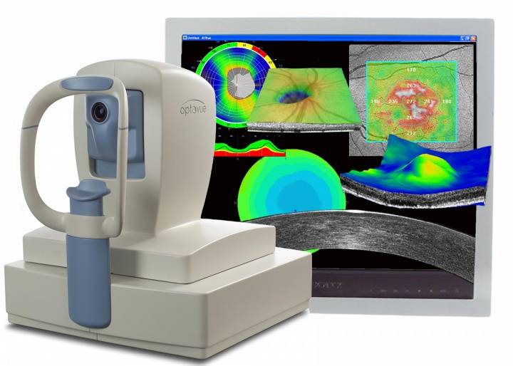 Оптическая когерентная томография глаза (окт): как проводится, расшифровка результатов и стоимость