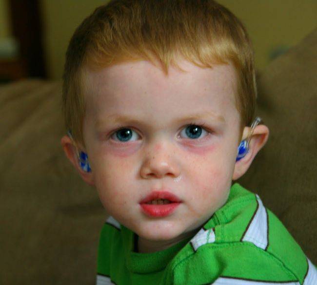 Синяки под глазами у ребенка: причины красных и синих кругов, от чего у малыша 2,3-5 лет появляются проблемы, как лечить малыша до года и после