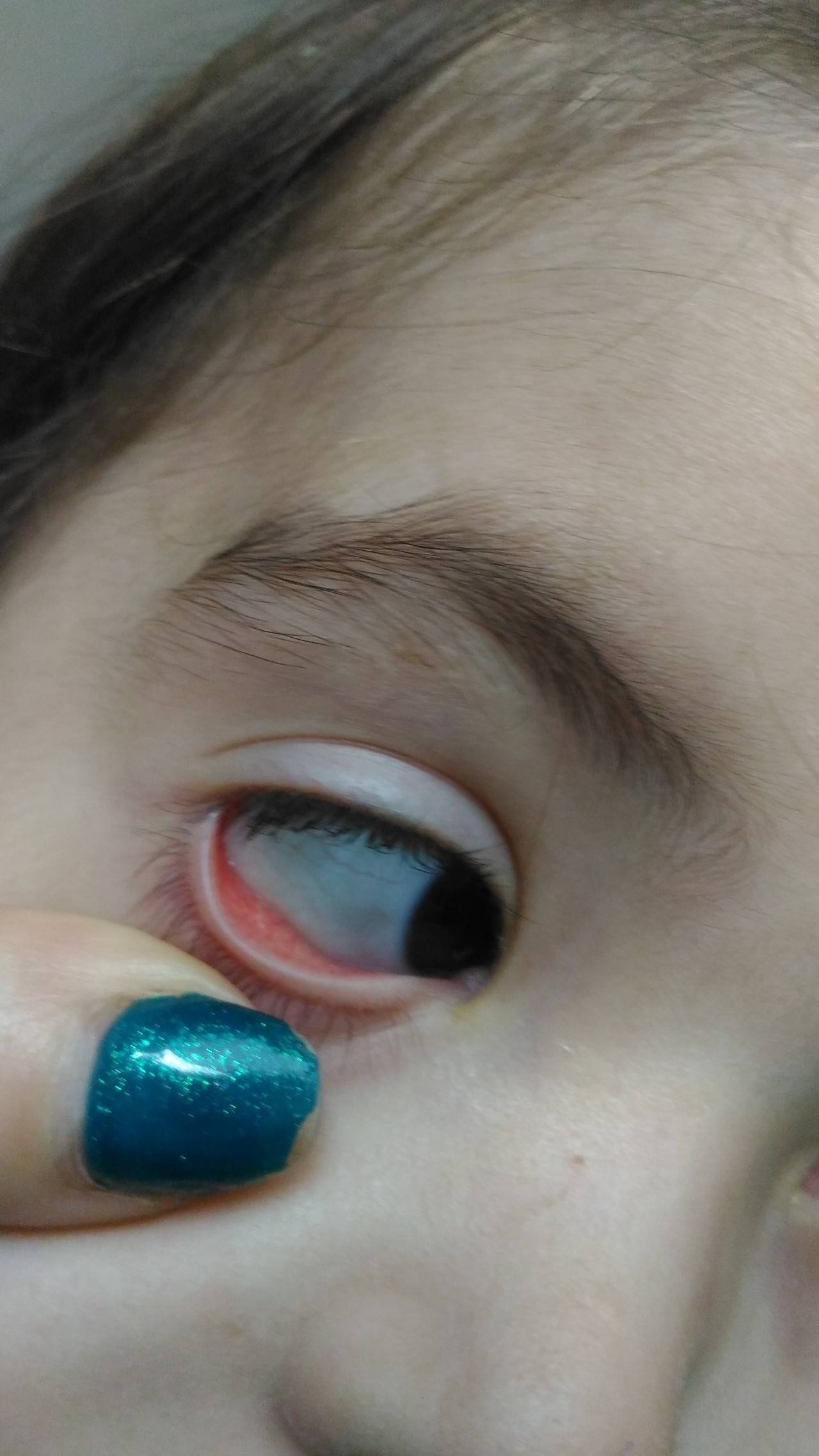 У ребенка на белках глаза серые пятна - онлайн врач