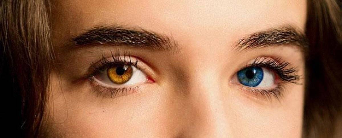 Что такое гетерохромия и и что могут сказать о человеке глаза разного цвета