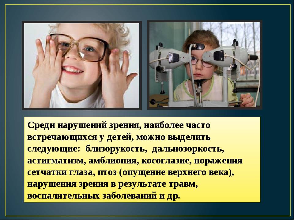 Ухудшение зрения: причины падения зрения у детей, резкое снижение зрения у взрослых, лечение  | азбука здоровья