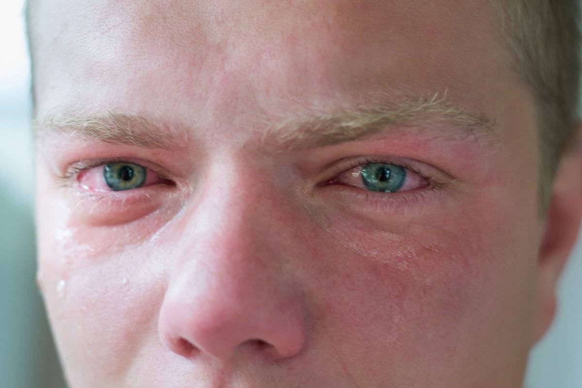 Почему слезятся глаза и как лечить слезоточивость эффективно