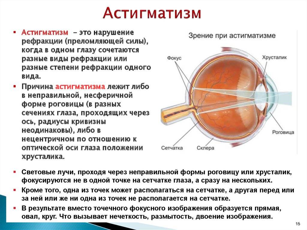 Как определить косоглазие: офтальмологические процедуры