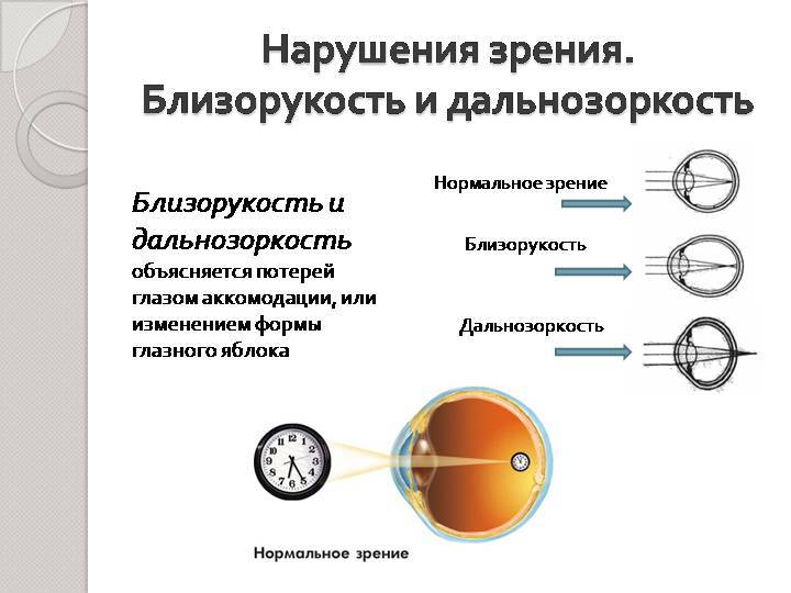 Зрение единица 1,0: что это значит, как видит человек oculistic.ru
зрение единица 1,0: что это значит, как видит человек