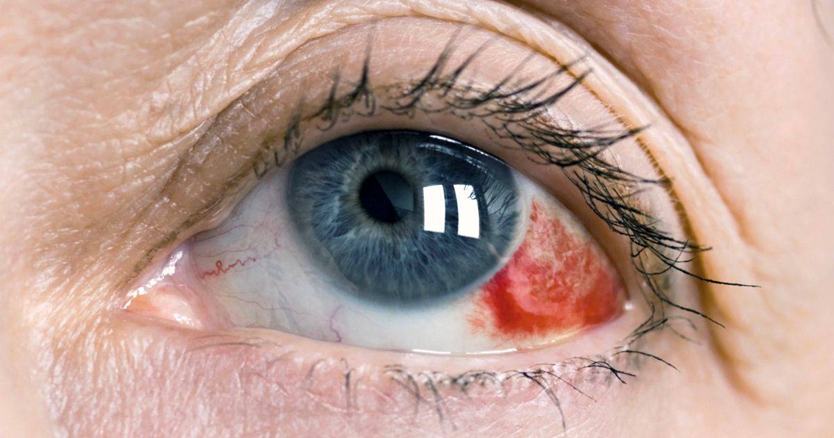 О чем говорят красные глаза у грудничков? как вылечить тревожные симптомы у самых маленьких