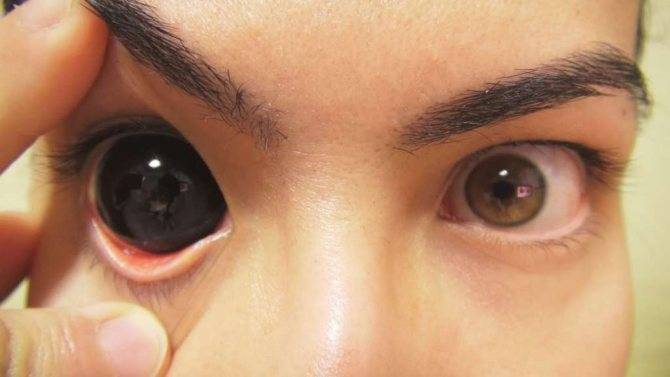 Четыре опасные ошибки тех, кто носит контактные линзы