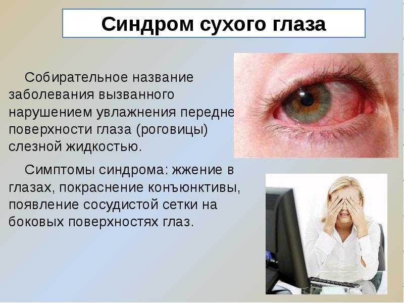Красные глаза от компьютера - что делать, последствия