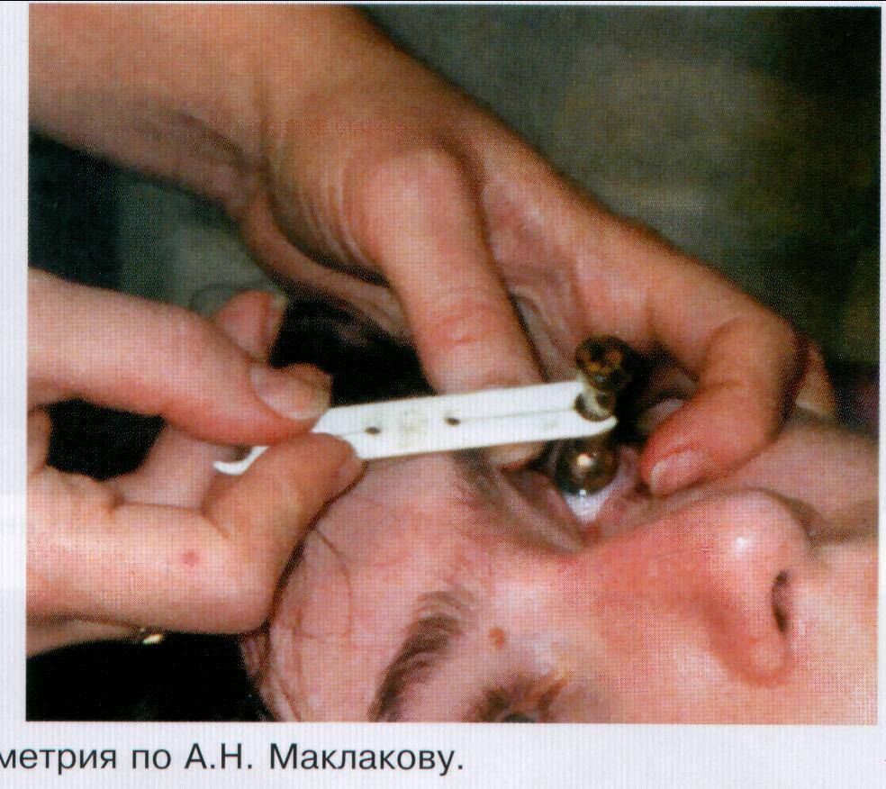 Что такое тонометрия глаза и как её проводят oculistic.ru
что такое тонометрия глаза и как её проводят