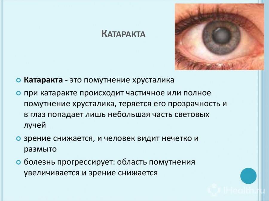 Причины помутнения в глазах, лечение и профилактика патологии