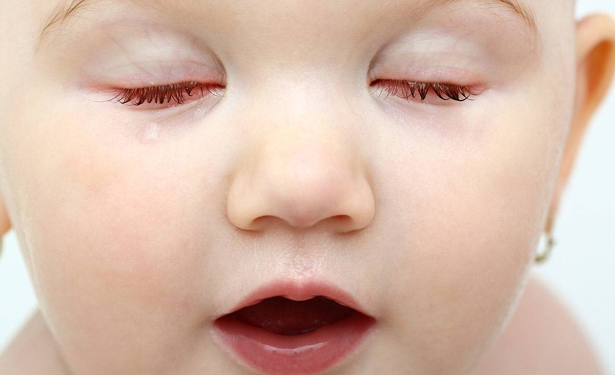 Причины, почему ребенок может часто моргать глазами