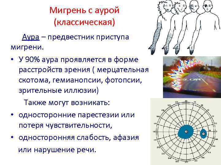 Мерцание в глазах: причины и лечение oculistic.ru
мерцание в глазах: причины и лечение