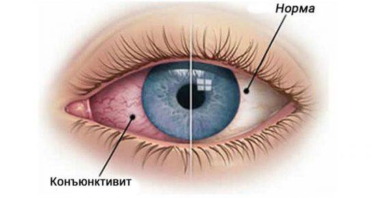 Конъюнктива глаза: строение и функции - "здоровое око"