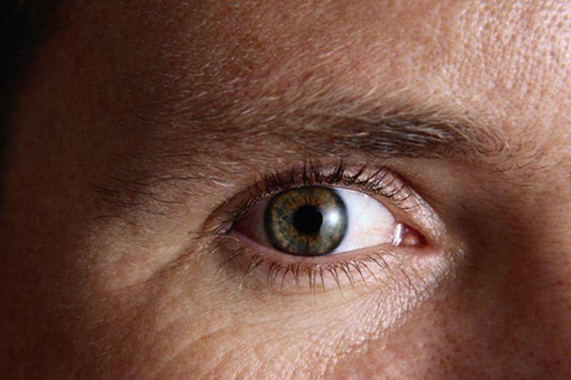 Голубой белок глаза что означает. почему у ребенка серые белки глаз