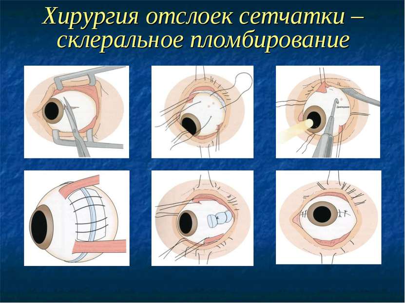 Форма глаз человека