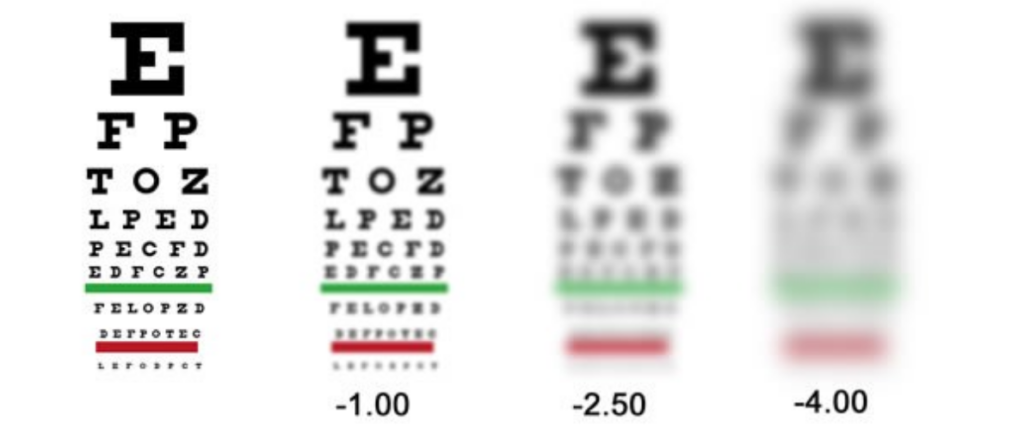 Как видит человек со зрением минус 2, особенности, методы лечения