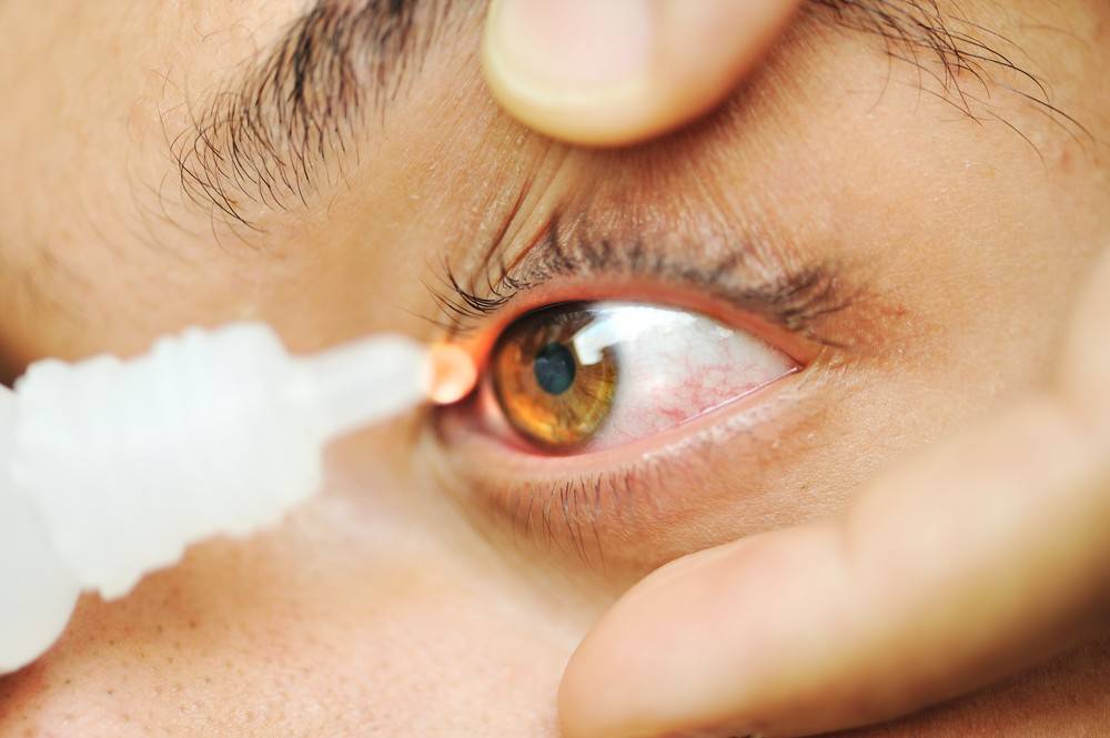Жжение в глазах – основные причины и методы лечения