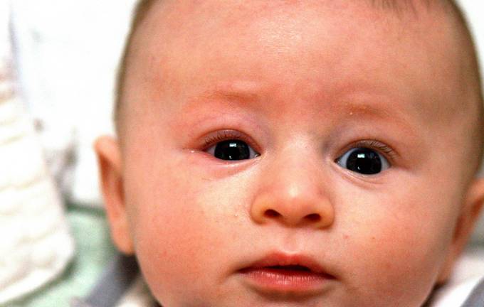 Красные глаза у новорожденного - причины, последствия, лечение