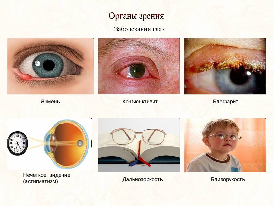 Болезни глаз у человека: список заболеваний, симптомы и особенности лечения