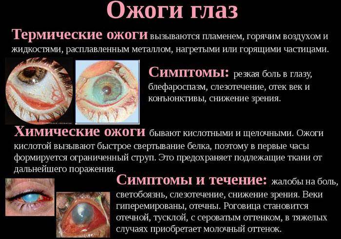 Химический ожог глаза: симптомы и лечение oculistic.ru
химический ожог глаза: симптомы и лечение