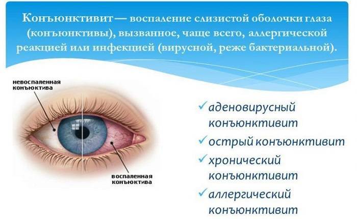 Симптомы, причины и методы лечения рези в глазах